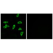 Immunofluorescence analysis of LOVO cells, using PTGER3 antibody.