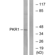 Western blot analysis of extracts from COLO cells, using PKR1 antibody.