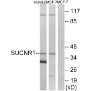 Western blot analysis of extracts from HUVEC cells and MCF-7 cells, using SUCNR1 antibody.