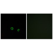 Western blot analysis of extracts from LOVO cells, using TAS2R10 antibody.