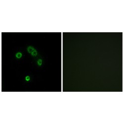 Taste 2 Receptor Member 13 (TAS2R13) Antibody