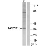 Western blot analysis of extracts from Jurkat cells, using TAS2R13 antibody.