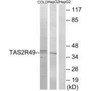 Western blot analysis of extracts from COLO cells and HepG2 cells, using TAS2R49 antibody.