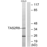 Western blot analysis of extracts from COLO cells, using TAS2R8 antibody.