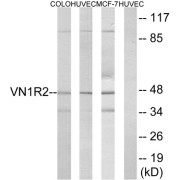 Western blot analysis of extracts from COLO cells, HUVEC cells and MCF-7 cells, using VN1R2 antibody.