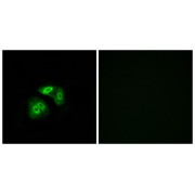 Vomeronasal 1 Receptor 5 (gene/pseudogene) (VN1R5) Antibody