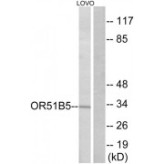 Western blot analysis of extracts from LOVO cells, using OR51B5 antibody.