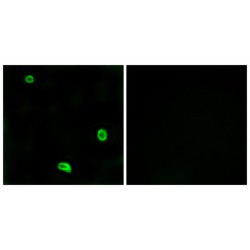 Protease Activated Receptor 4 (PAR4) Antibody