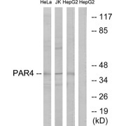 Western blot analysis of extracts from HeLa cells, Jurkat cells and HepG2 cells, using PAR4 antibody.