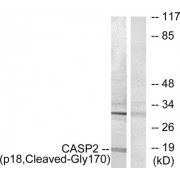 Western blot analysis of extracts from Jurkat cells, treated with etoposide (25uM, 24hours), using CASP2 (p18, Cleaved-Gly170) antibody.
