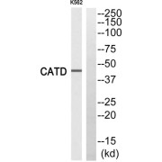 Western blot analysis of extracts from K562 cells, using CATD (light chain, Cleaved-Gln161) antibody.