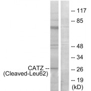 Western blot analysis of extracts from COS-7 cells, treated with etoposide (25uM, 1hour), using CATZ (Cleaved-Leu62) antibody.