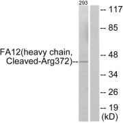 Western blot analysis of extracts from 293 cells, treated with etoposide (25uM, 1hour), using FA12 (heavy chain, Cleaved-Arg372) antibody.