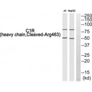 Western blot analysis of extracts from Jurkat cells and HepG2 cells, using C1R (heavy chain, Cleaved-Arg463) antibody.