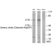 Western blot analysis of extracts from 293 cells treated with etoposide (25uM, 1hour) and HeLa cells treated with etoposide (25uM, 24hours), using C1S (heavy chain, Cleaved-Arg437) antibody.