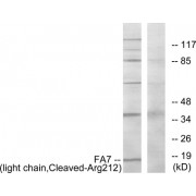 Western blot analysis of extracts from Jurkat cells, treated with eto (25uM, 24hours), using FA7 (light chain, Cleaved-Arg212) antibody.