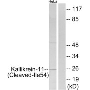 Western blot analysis of extracts from HeLa cells, treated with etoposide (25uM, 24hours), using Kallikrein-11 (Cleaved-Ile54) antibody.