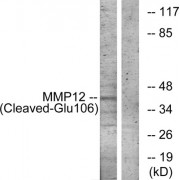 Western blot analysis of extracts from NIH-3T3 cells, treated with etoposide (25uM, 1hour), using MMP12 (Cleaved-Glu106) antibody.