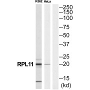 Western blot analysis of extracts from K562 cells and Hela cells, using RPL11 antibody. The lane on the right is treated with the synthetic peptide.