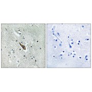 IHC analysis of paraffin-embedded human brain tissue, using ROBO2 Antibody. The picture on the right is blocked with the synthesised peptide.