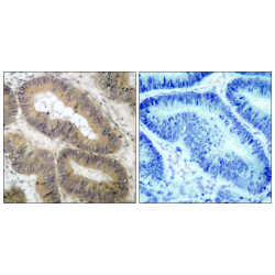 Inhibitor of Nuclear Factor Kappa-B Kinase Subunit Alpha Phospho-Thr23 (CHUK pT23) Antibody