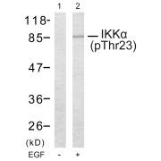 Western blot analysis of (1) untreated, and (2) EGF-treated MDA-MB-435 cells, using CHUK/IKKA pT23 Antibody.