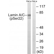 Western blot analysis of lysates from HeLa cells treated with paclitaxel (1 µM 24 h), using Lamin A (Phospho-Ser22) Antibody. The lane on the right is blocked with the phosphopeptide.