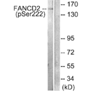 Western blot analysis of extracts from HT-29 cells, treated with Calyculin A (50 ng/ml, 30mins), using Fanconi Anemia Group D2 Protein (FANCD2) (Phospho-Ser222) antibody.