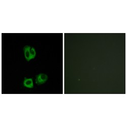 Proto-Oncogene Tyrosine-Protein Kinase LCK Phospho-Tyr394 (LCK pY394) Antibody