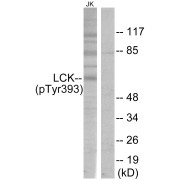 Western blot analysis of Jurkat cell lysates, using Proto-Oncogene Tyrosine-Protein Kinase LCK Phospho-Tyr394 (LCK pY394) Antibody. The lane on the right is blocked with the phosphopeptide.