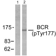 Western blot analysis of lysates from K562 cells, using BCR pY177 Antibody. The lane on the left is blocked with the phosphopeptide.