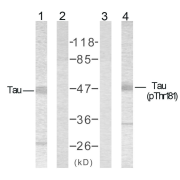 WB analysis of Mouse brain tissue, using MAPT T181 Antibody in lanes 1 and 2, and MAPT phopshoT181 Antibody (abx119537) in lanes 3 and 4.
