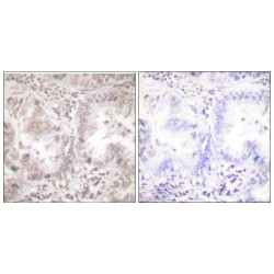 RAC-Alpha Serine/threonine-Protein Kinase (Akt) Antibody