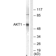 Western blot analysis of NIH/3T3 cells treated with serum (10%, 30 min), using Akt antibody. The lane on the right is blocked with the synthesised peptide.