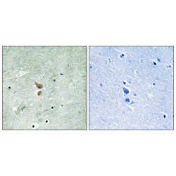 Receptor Interacting Serine Threonine Kinase 2 Phospho-Ser176 (RIPK2 pS176) Antibody