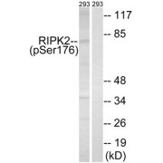 Western blot analysis of extracts from 293 cells, treated with UV (15 mins), using RIPK2 (Phospho-Ser176) antibody. The lane on the right is treated with the synthesized peptide.