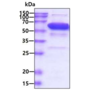 Human Catalase (CAT) Enzyme (Active)