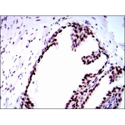 Replication Protein A 70 kDa DNA-Binding Subunit (RPA1) Antibody