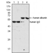 Western blot analysis using human Albumin antibody (lane 3, 4) and human IgG antibody (lane 1, 2) against human serum (lane 1, 3) and plasma (lane 2, 4).