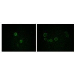 Apolipoprotein M (ApoM) Antibody