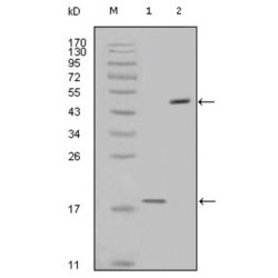 Baculoviral IAP Repeat-Containing Protein 5 (BIRC5) Antibody