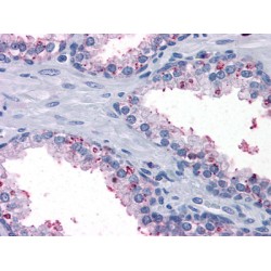 D-Beta-Hydroxybutyrate Dehydrogenase, Mitochondrial (BDH1) Antibody