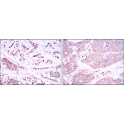 Beclin 1 (BECN1) Antibody