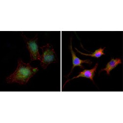 Catenin Beta 1 (CTNNB1) Antibody