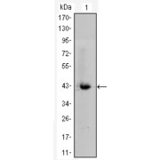 Western blot analysis using CTNNB1 antibody against CTNNB1-hIgGFc transfected HEK293 cell lysate.