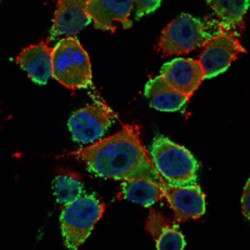 Carcinoembryonic Antigen (CEACAM5) Antibody