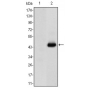 Western blot analysis using CEA antibody against HEK293 (1) and CEA (AA: 460-600) -hIgGFc transfected HEK293 (2) cell lysate.