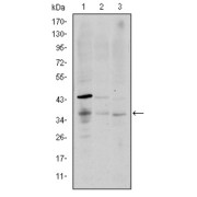 Western blot analysis using CD1A antibody against K562 (1), RAJI (2), and MOLT4 (3) cell lysate.