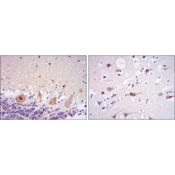 Cyclin-Dependent-Like Kinase 5 (CDK5) Antibody