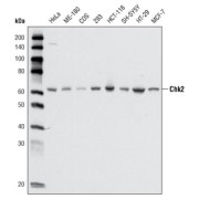 Western blot analysis using CHK2 antibody against cell lysate from various cell types.